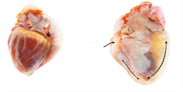 a healthy heart and an alcohol -affected heart