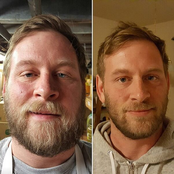the person’s appearance before and after stopping drinking alcohol